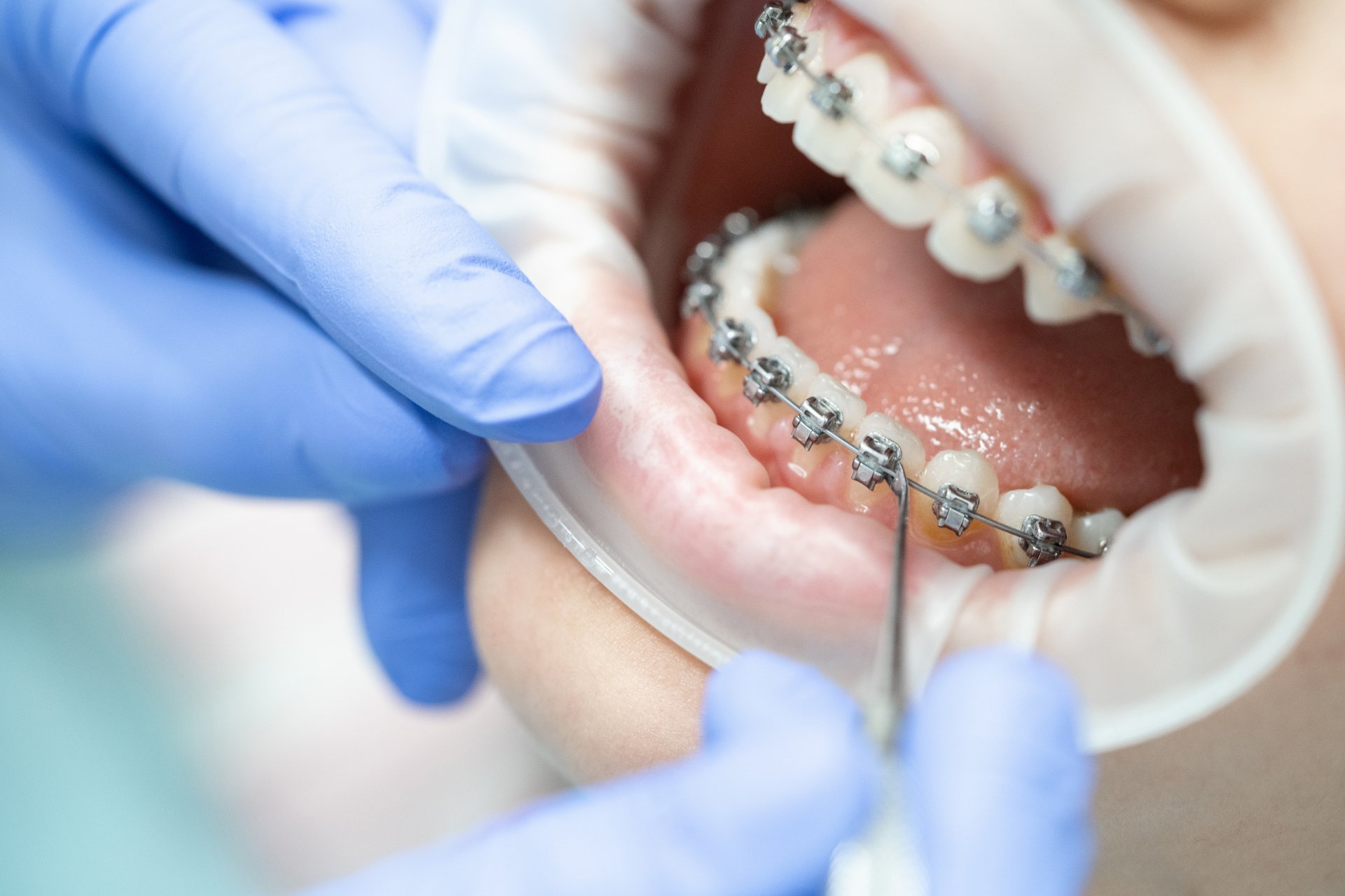 ortodoncja szczecin