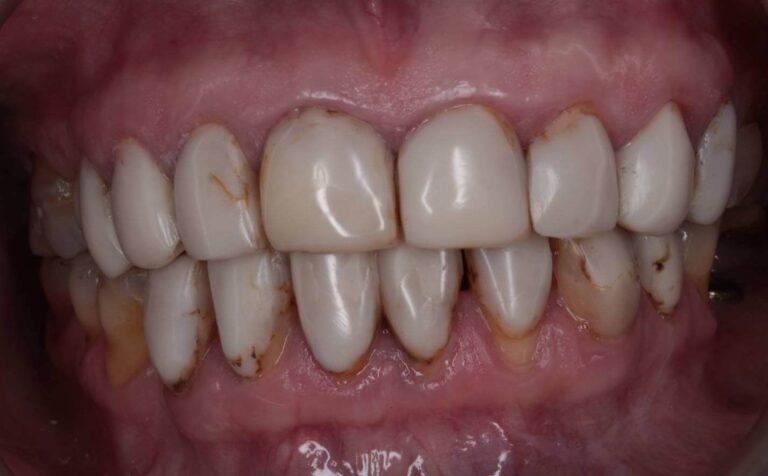 Metamorfoza 7 - przed